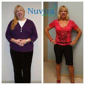 Weight Loss Naples Val